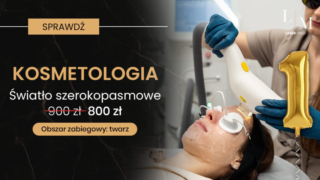 swiatloszerokopasmowe rumien naczynka przebarwienia laser